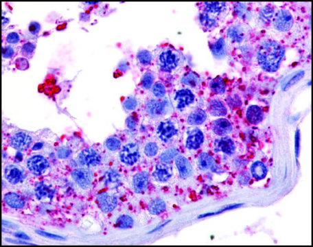 Anti-PRKWNK1 (AB2) antibody produced in