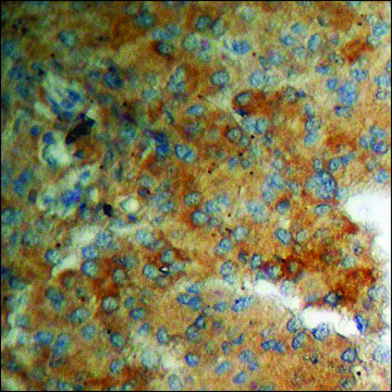 Anti-phospho-ADD1 (pThr???) antibody produced in