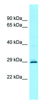 Anti-CEMP1 (C-terminal) antibody produced in
