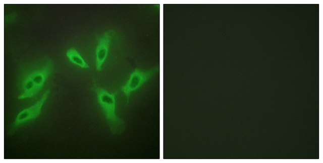 Anti-TUSC3 antibody produced in rabbit