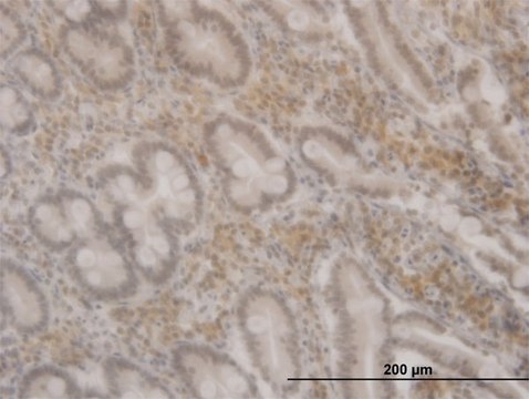 ANTI-FOXO3A antibody produced in mouse