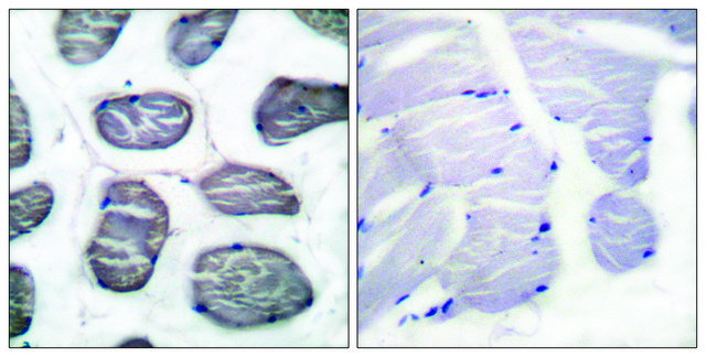 Anti-ACTIN-?-1 antibody produced in rabbit