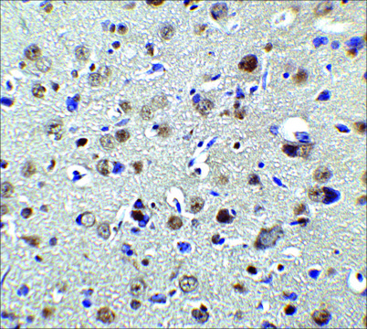 Anti-PLAGL2 antibody produced in rabbit