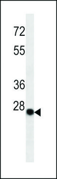 MONOCLONAL ANTI-KAPPA LIGHT CHAIN antibody