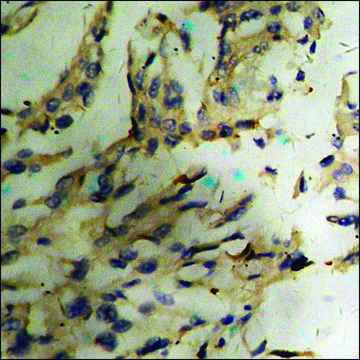 Anti-phospho-NFAT4 (pSer¹??) antibody produced in