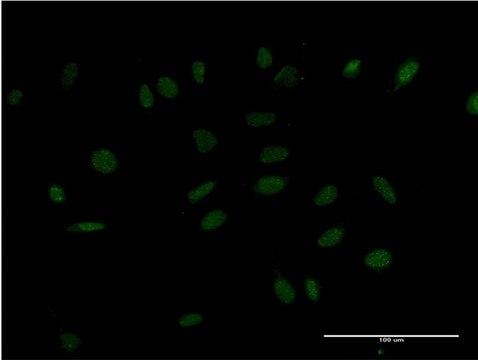 ANTI-HMX2 antibody produced in mouse