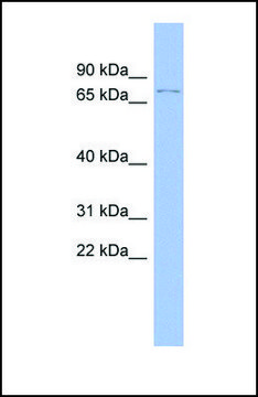 Anti-TP73 antibody produced in rabbit