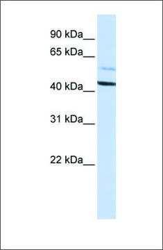 Anti-PSMD4 antibody produced in rabbit