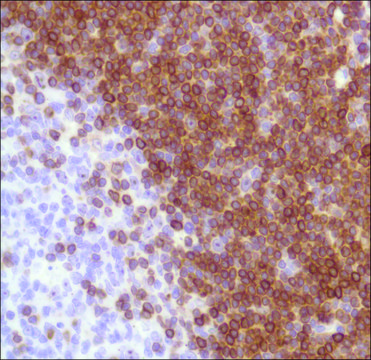Anti-BCL-2 Alpha antibody, Rabbit monoclonal