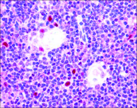 Anti-AIRE (Isoform 1) antibody produced