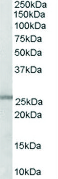 Anti-GSTM1/GSTM2 antibody produced in goat
