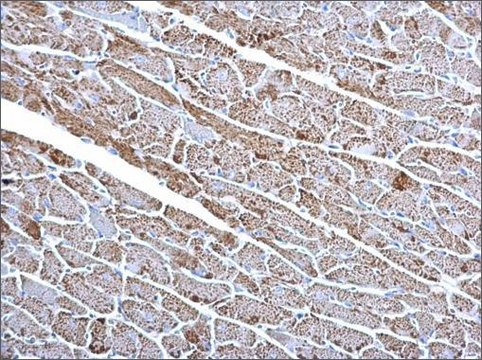 Monoclonal Anti-Citrate synthetase antibody produced