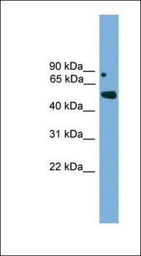 Anti-IRX5 antibody produced in rabbit