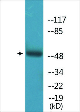 Anti-phospho-PTP1B (pSer??) antibody produced in