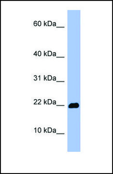 Anti-OMP antibody produced in rabbit