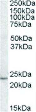 Anti-KLF16/DRRF antibody produced in goat