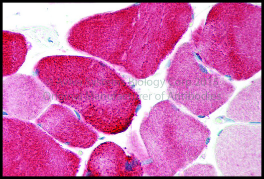 Anti-KCNJ12 antibody produced in rabbit