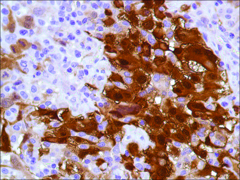 Anti-Calretinin antibody, Rabbit monoclonal