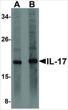 Anti-IL-17 (ab1) antibody produced in