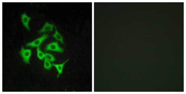 Anti-GPR100 antibody produced in rabbit