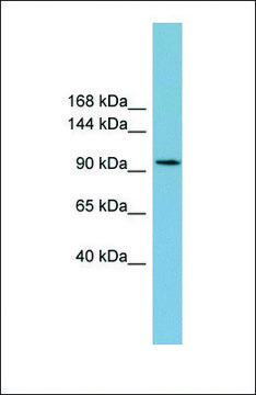 Anti-SLC12A3 antibody produced in rabbit