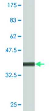 Monoclonal Anti-ATP7B, (C-terminal) antibody produced
