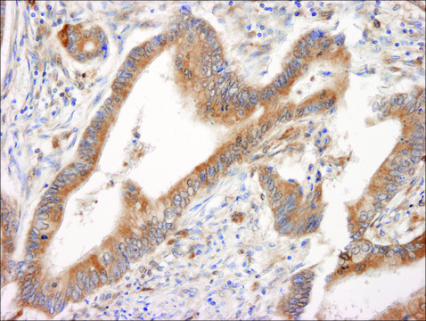 Rabbit anti-PML Antibody, Affinity Purified