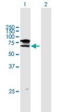 ANTI-ST6GALNAC1 antibody produced in mouse