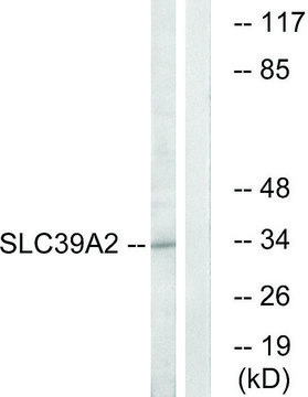 Anti-SLC39A2 antibody produced in rabbit