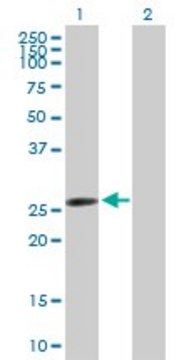 Anti-AK2 antibody produced in mouse