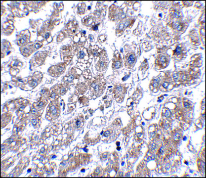 Anti-MATN1 antibody produced in rabbit