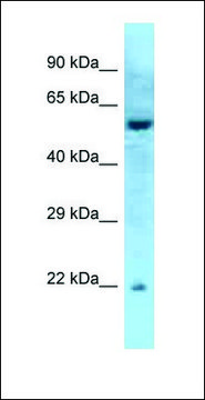 Anti-RAB27A antibody produced in rabbit