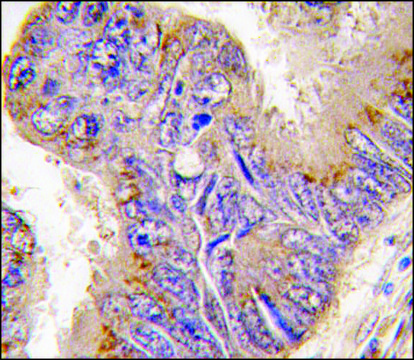 Anti-DCAMKL3 (center) antibody produced in