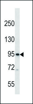 ANTI-CNGB3 (N-TERM) antibody produced in