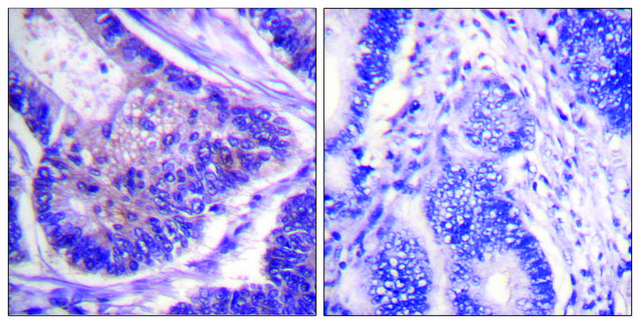Anti-EIF4B antibody produced in rabbit