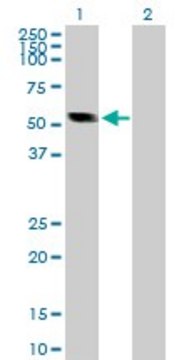 Anti-CASQ2 antibody produced in rabbit