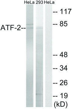 Anti-ATF2 antibody produced in rabbit