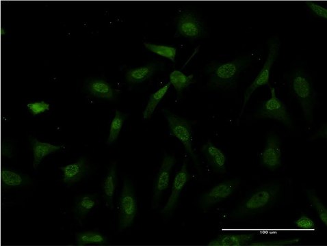 ANTI-IKBKB antibody produced in mouse