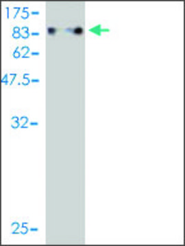 ANTI-ZNF394 antibody produced in mouse