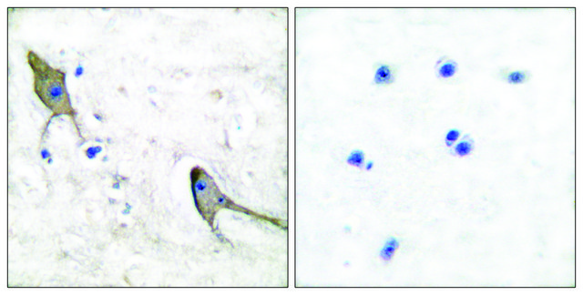Anti-PYK2 antibody produced in rabbit