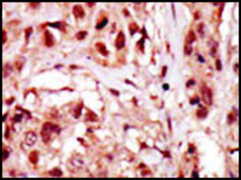 Anti-PRPK (center) antibody produced in