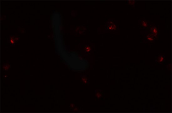 Anti-CRIM1 antibody produced in rabbit