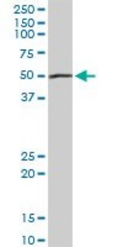 Anti-PEPD antibody produced in rabbit