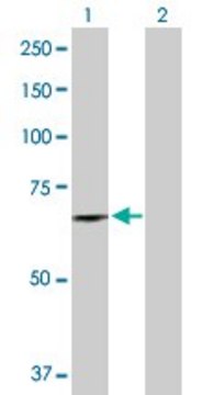 Anti-DDX56 antibody produced in rabbit