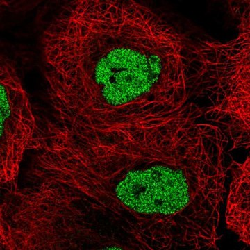 Anti-CSNK2A1 antibody produced in rabbit