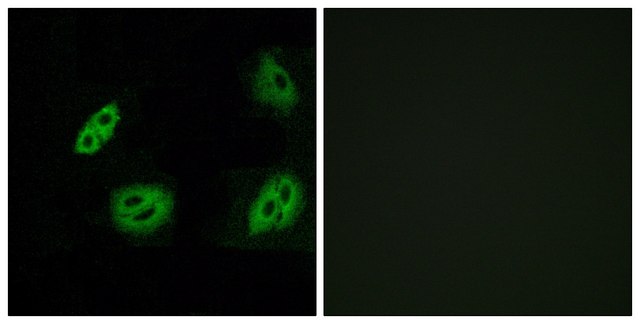 Anti-OR4B1 antibody produced in rabbit