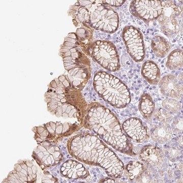 Anti-SLC25A40 antibody produced in rabbit