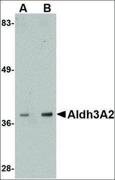Anti-Aldh3A2 antibody produced in rabbit