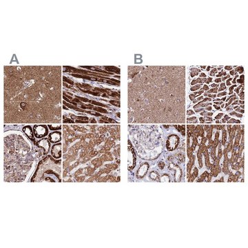Anti-ATP5H antibody produced in rabbit