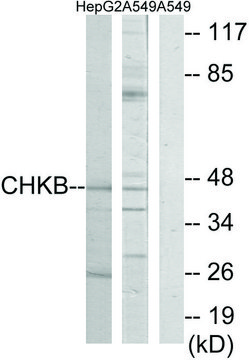 Anti-CHKB antibody produced in rabbit